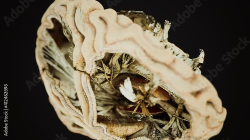 medical anotomy of real human brain photo