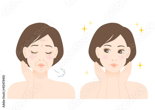 シワ・たるみに悩む女性のイラスト: ビフォーアフター