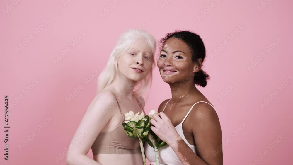Diverse beauty concepts. Group of women with different kind of skin posing together Diverse beauty concepts. Group of women with different kind of skin posing together