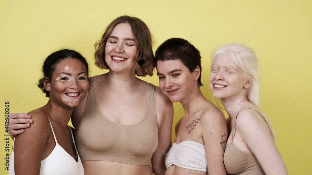 Diverse beauty concepts. Group of women with different kind of skin posing together Diverse beauty concepts. Group of women with different kind of skin posing together