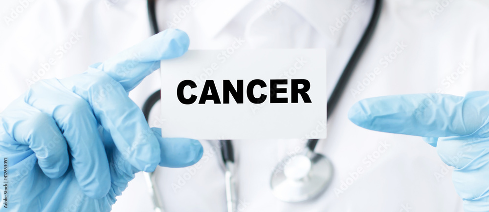 in the hands of the doctor card with the text CANCER. Medical concept. in the hands of the doctor card with the text CANCER. Medical concept.