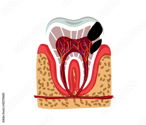 tooth part of human body anatomy and disease
