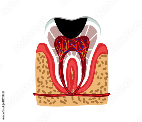 tooth part of human body anatomy and disease