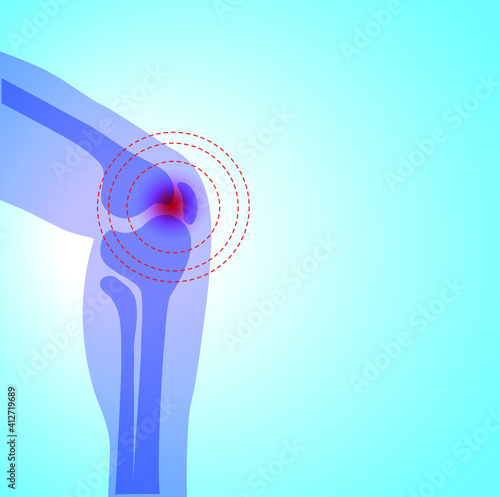 Joint pain illustration. Bone pain. Ache. Arthritis. Orthopedic medical concept.