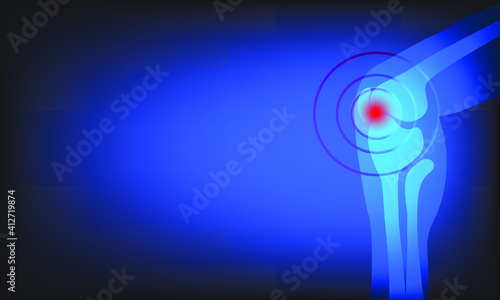 Joint pain illustration. Bone pain. Ache. Arthritis. Orthopedic medical concept.