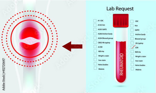 Illustration of blood test tube for Rheumatoid arthritis. 
