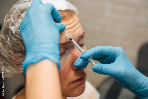 Injection of hyaluronic acid filler under the skin on face of forty years woman, closeup. Botulinum therapy in cosmetology. Doctor makes rejuvenating facial injections for smoothing forehead wrinkles.