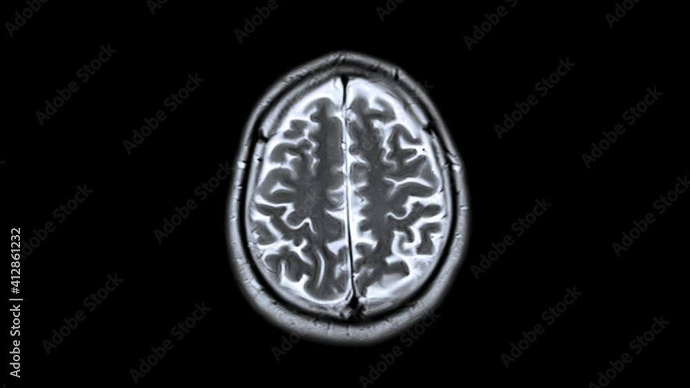 Brain Mr. Healthcare Concept. Magnetic Resonance Imaging of Human Brain. Checking Cranium. Scanning of Man Head. MRI. Brain Mr. Healthcare Concept. Magnetic Resonance Imaging of Human Brain. Checking Cranium. Scanning of Man Head. MRI.