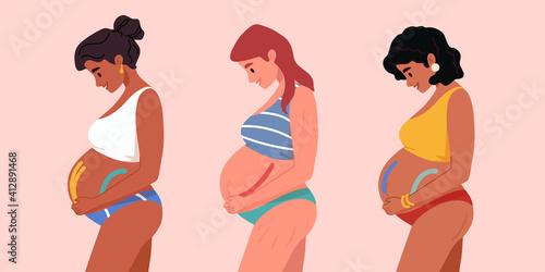 Beautiful smiling pregnant african american women in underwear or swimsuit. Pregnancy belly with kinesio taping, Kinesiology . Motherhood. New born. Young dark skinned mother.