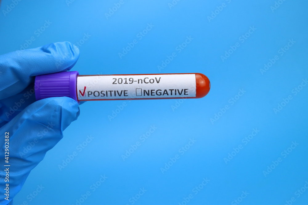 Obraz premium Doctor, nurse keep positive blood test for coronavirus