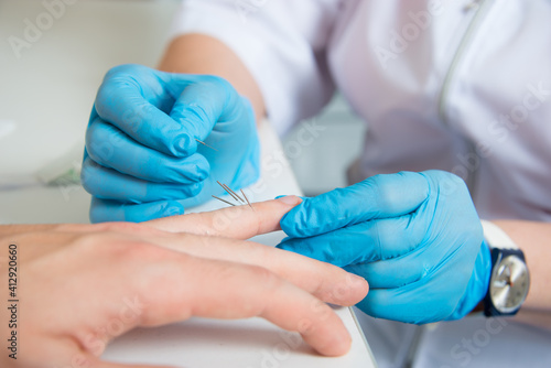 The doctor conducts acupuncture, treatment of diseases of the nervous system.