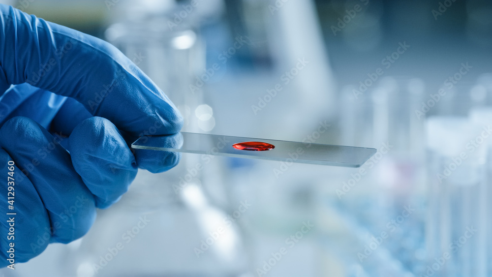 Close Up Macro Shot of a Scientist in Gloves Holding Red Chemical Liquid on a Microscope Sample Plate. Microbiologist Working in Laboratory with Technological Equipment. Close Up Macro Shot of a Scientist in Gloves Holding Red Chemical Liquid on a Microscope Sample Plate. Microbiologist Working in Laboratory with Technological Equipment.