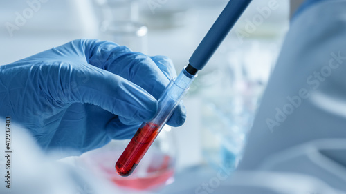 Close Up Shot of a Scientist in Gloves Using Micro Pipette and Taking a Red Chemical Liquid or Blood for testing on a Microscope. Microbiologist Working in Laboratory with Technological Equipment.
