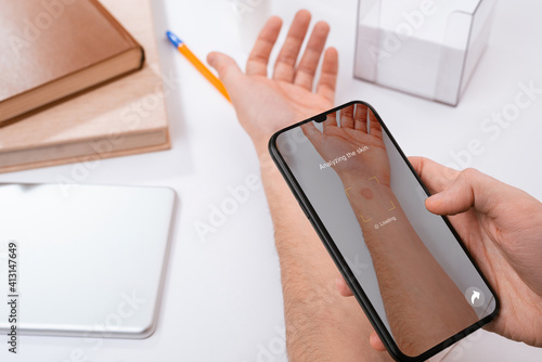 Man using a phone app to identify a red spot on his hand