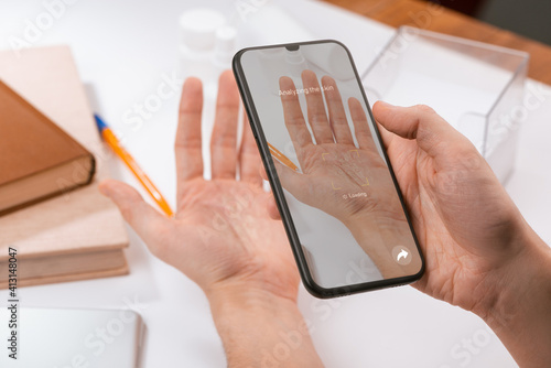 Man using a phone app to recognize the disease on his palm
