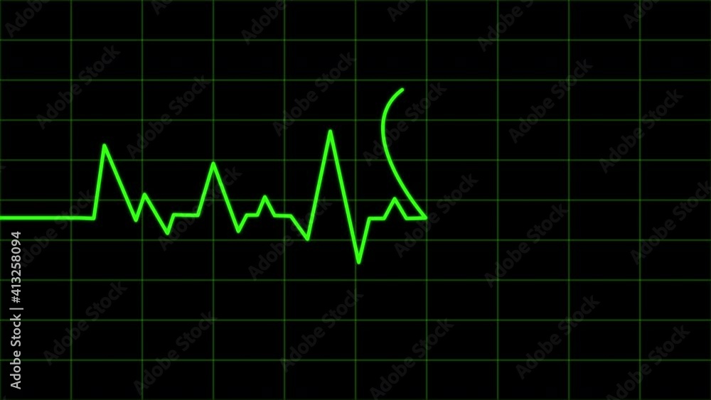 Heartbeat Medical Cardiogram Animation,Heartbeat green animation