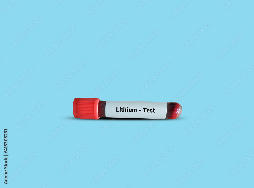 Test Tube with blood sample for Lithium level test. This test helps to determine the therapeutic