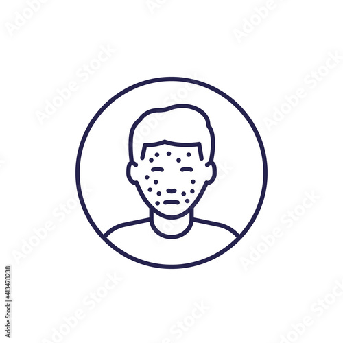 Free Download acne icon, skin problem, rash line vector - GFXLoad