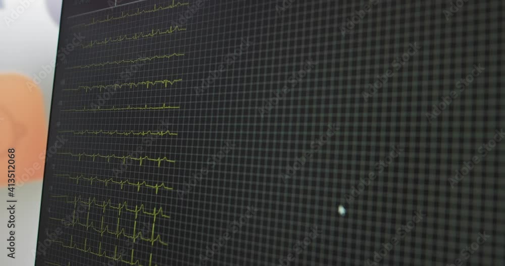 Heart rate monitor in hospital theater. Medical vital signs monitor