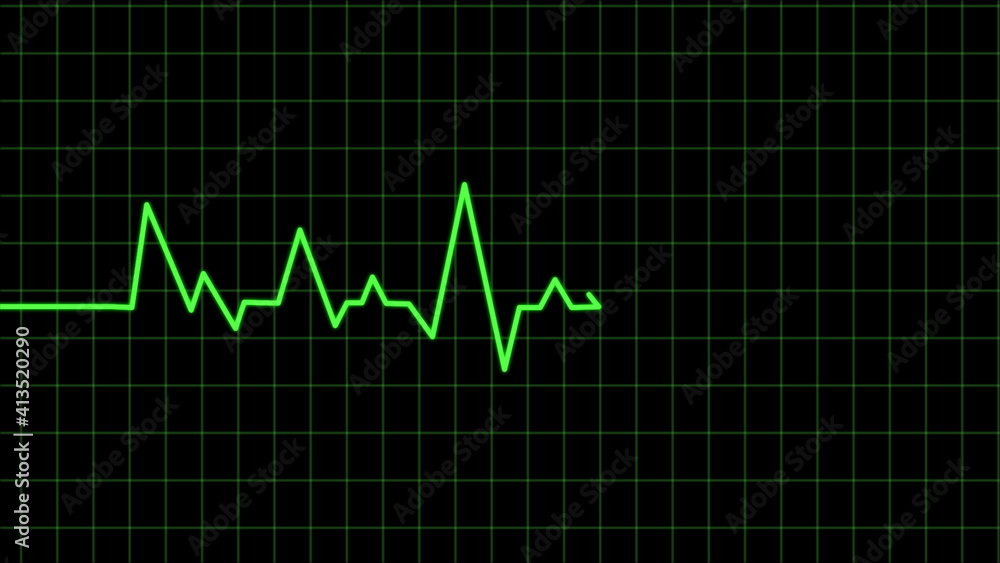 Naklejka premium heart beat on monitor