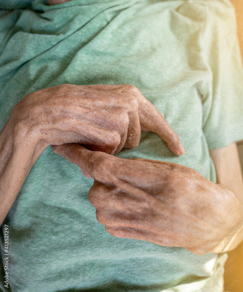 Fototapeta premium The elderly patient's hand is bent