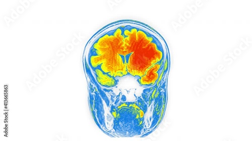 Computed medical tomography MRI upscaled scan of healthy young female head. Front view. Optically retimed for smooth motion. Red, yellow, blue on white background. photo