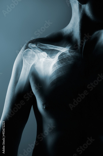 Human shoulder joint in x-ray on gray background