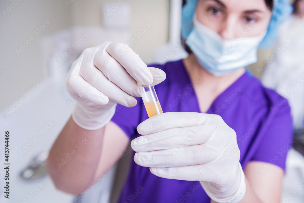 Platelet-Rich plasma preparation. Tube with plasma in hands Platelet-Rich plasma preparation. Tube with plasma in hands
