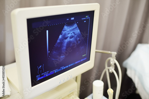 the result of an ultrasound of the abdominal cavity on the monitor close-up