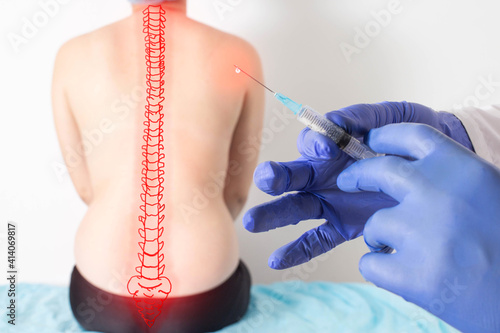 The doctor holds a syringe with medical medicine against the background of a patient with back pain. Concept of medical treatment blockade with ozone and anti-inflammatory drugs