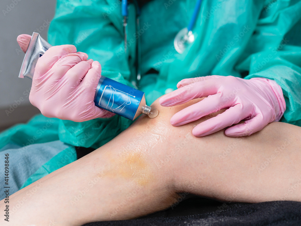 Doctor in gloves, close-up smears anesthetic ointment on knee injury in clinic. Doctor in gloves, close-up smears anesthetic ointment on knee injury in clinic.