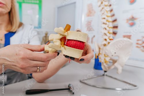 Фотография Doctor physiotherapist explaining the mechanism of injury using vertebra model