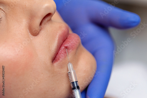 Close up Botox injection into the lips of a young girl. Lip augmentation. Needle and syringe. Injection in cosmetic surgery.