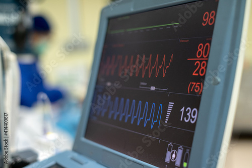 EKG monitor in intra aortic balloon pump machine. Medical equipment.