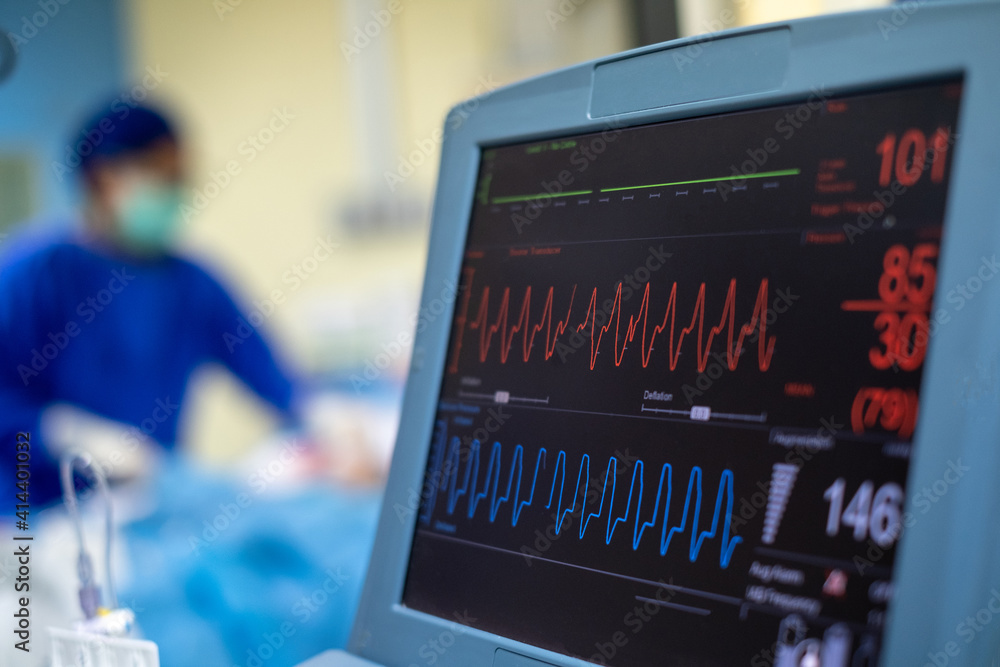 EKG monitor in intra aortic balloon pump machine. Medical equipment. - obrazy, fototapety, plakaty 