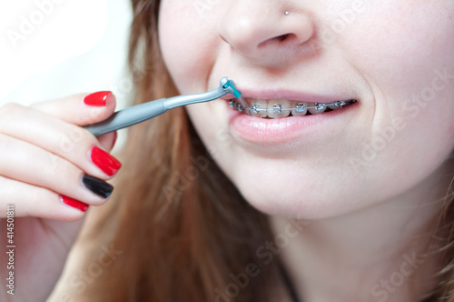 Face of a young woman with braces on her teeth  she is using a toothbrush