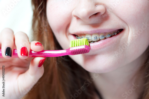 Face of a young woman with braces on her teeth, she is using a toothbrush