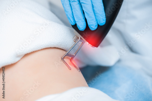 Close up of laser body scar removal process. Modern cosmetology apparatus