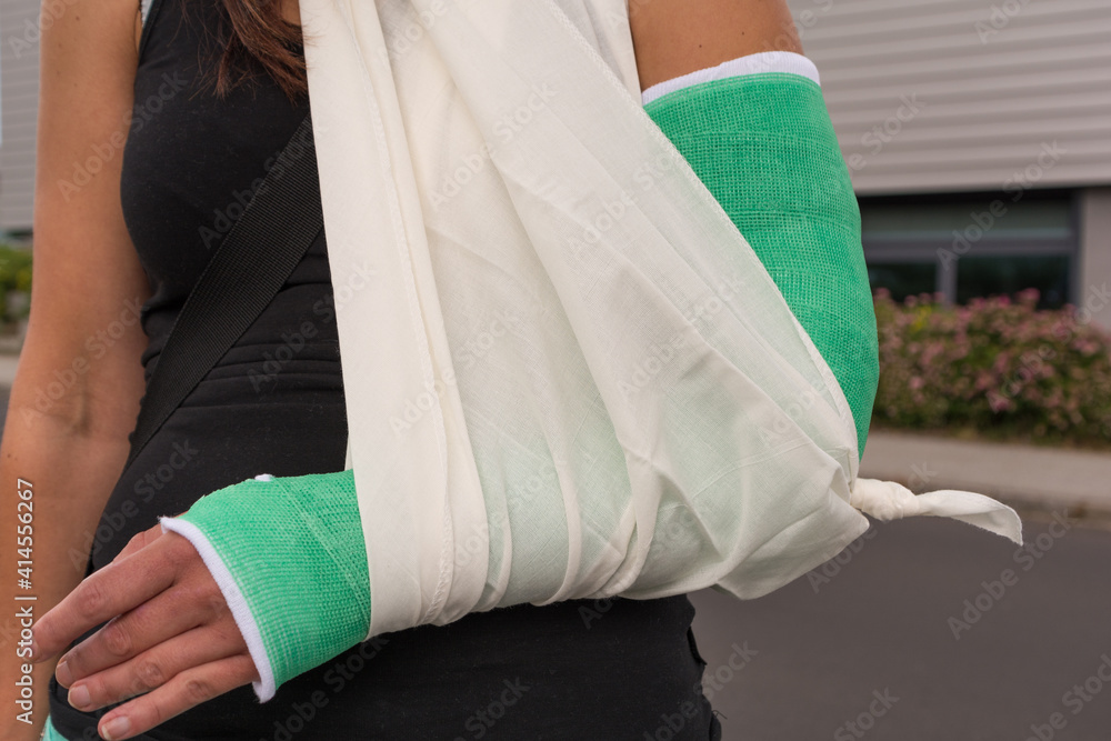 Woman With Broken Arm In A Supporting Loop