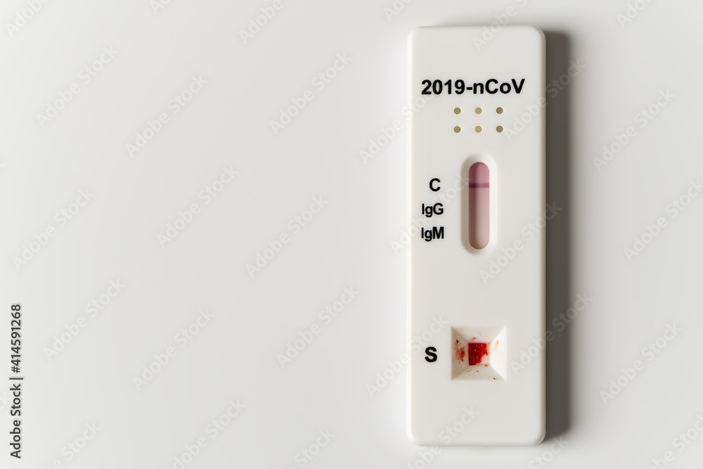COVID test and laboratory sample of blood testing for diagnosis new Corona virus infection COVID test and laboratory sample of blood testing for diagnosis new Corona virus infection