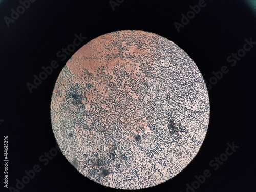 Microscopic observation of microbial culture results