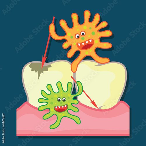 tooth bacteria and tooth for dentistry or stomatologist or dental clinic poster. flat vector illustration