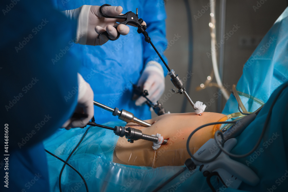 Endoscopic surgery to remove the uterus Stock Photo Adobe Stock