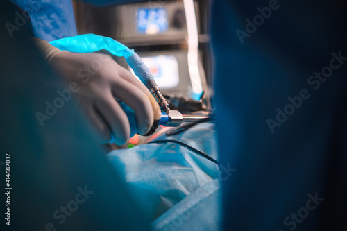 Endoscopic surgery to remove the uterus