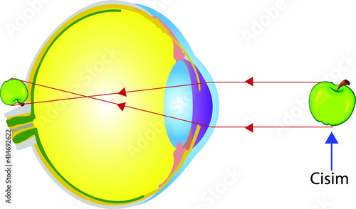 Vector Illustration of an Eye Anatomy Hypermetrope, Longsighted, Farsighted
