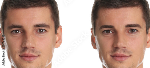 Man before and after eyebrow modeling on white background, collage. Banner design