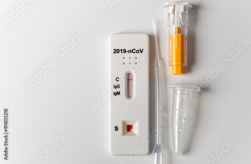 COVID-19 test and laboratory sample of blood testing for diagnosis new Corona virus infection
