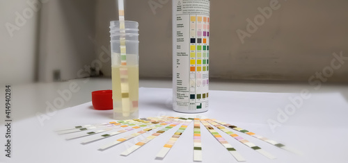 urine sample along with dip stick uristix for analyzing urine glucose protein albumin in diabetes photo