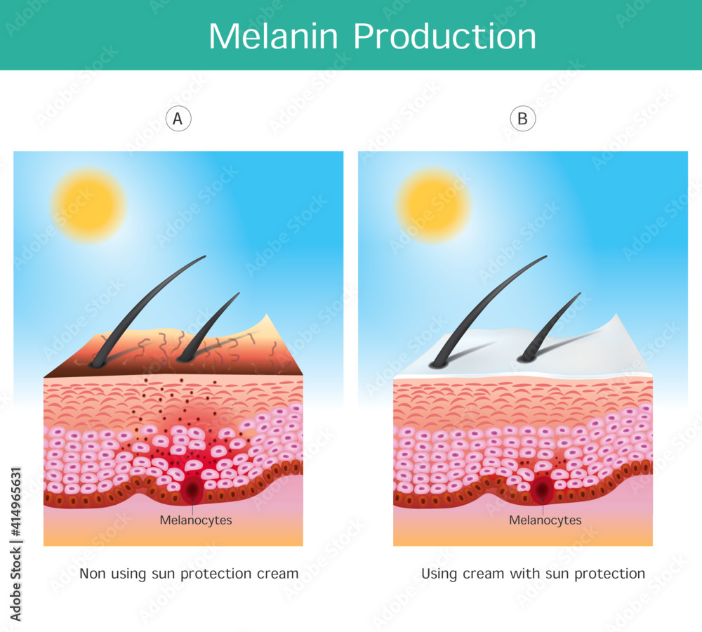 Melanin Production. Illustration showing colour human skin affect from ...