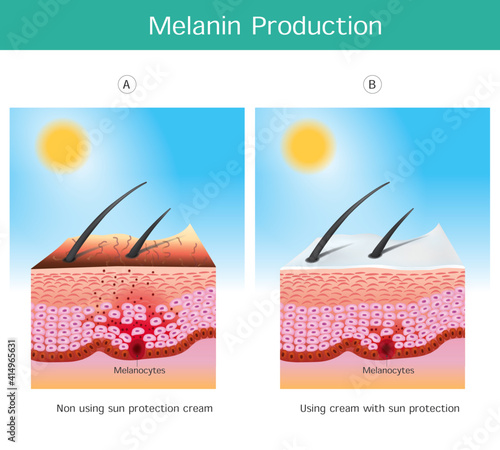 Melanin Production. Illustration showing colour human skin affect from UV rays the cause of stimulations melanocyte cell in skin layers..